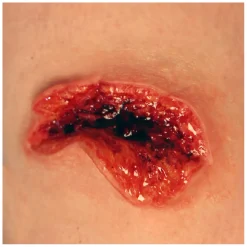 P.T.M. MO-AV-001 - Large Avulsion Mold