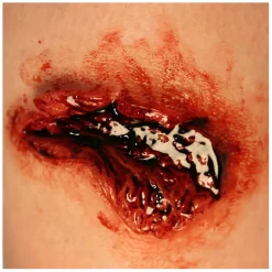 P.T.M. MO-AV-001 - Large Avulsion Mold