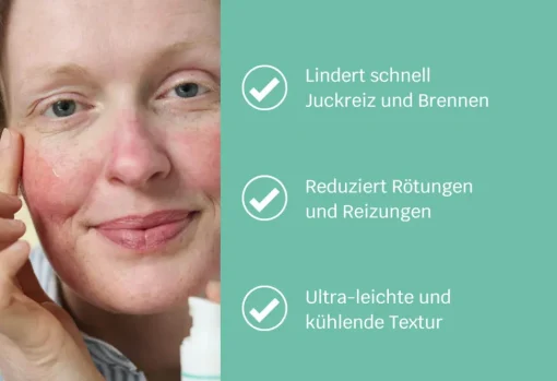 Siriderma Anti-Juckreiz GEL - ohne Duft - 30ml